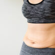 A close-up of a woman's belly, showing stretch marks and loose skin, which are the result of weight loss.